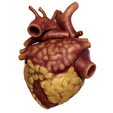 Obese_004.png Anatomical model of obese heart