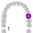 2022-07-09_00028-001-preview.png ANATOMICAL CROWN PIECE 26