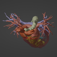 5.png 3D Model of Human Heart with Co-Arctation (CA) - generated from real patient