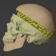 2.png 3D Model of Skull and Brain with Brain Stem