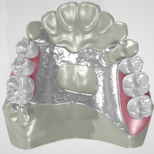 denture 様　NEIGHBORHOOD denture 様 NEIGHBORHOOD SMILE AGAIN DENTURES CENTER - CLOSED