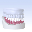 3.png Digital Single Jaw Full Denture