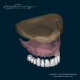 Printable-Denture-3D-Print-Vladyslav-Peerverzyev-1.png Druckbarer Zahnersatz - 3D-Druck