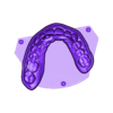 789513050_20240808_0848_Tech_01_K_bruxi_UnsectionedModel_UpperJaw.stl DIGITAL BRUXISM TRAY/SPLINT - 3 stl files (tray+model+antagonist)