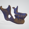 Screenshot_1.png Jaw with Bone Damage