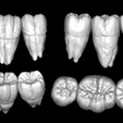 3-Lowers-HD.png Lower Dental Anatomy Study Model -  Updated: Added HD Buccal Sculpt