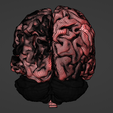 13.png 3D Model of Brain - section
