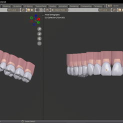imagen_2022-09-18_213744484.png STL file Upper arch Teeth with socket and gingivae・3D printing design to download