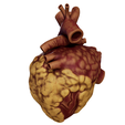 Obese_003.png Anatomical model of obese heart