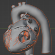3.png 3D Model of Heart with Tetralogy of Fallot (ToF)