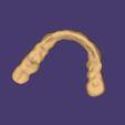 Clipboard-2024-08-24-14-43-55.jpg DIGITAL BRUXISM TRAY/SPLINT - 3 stl files (tray+model+antagonist)