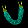 LowerJaw-articulator.png Dental Model With 10 Veneers and Articulator