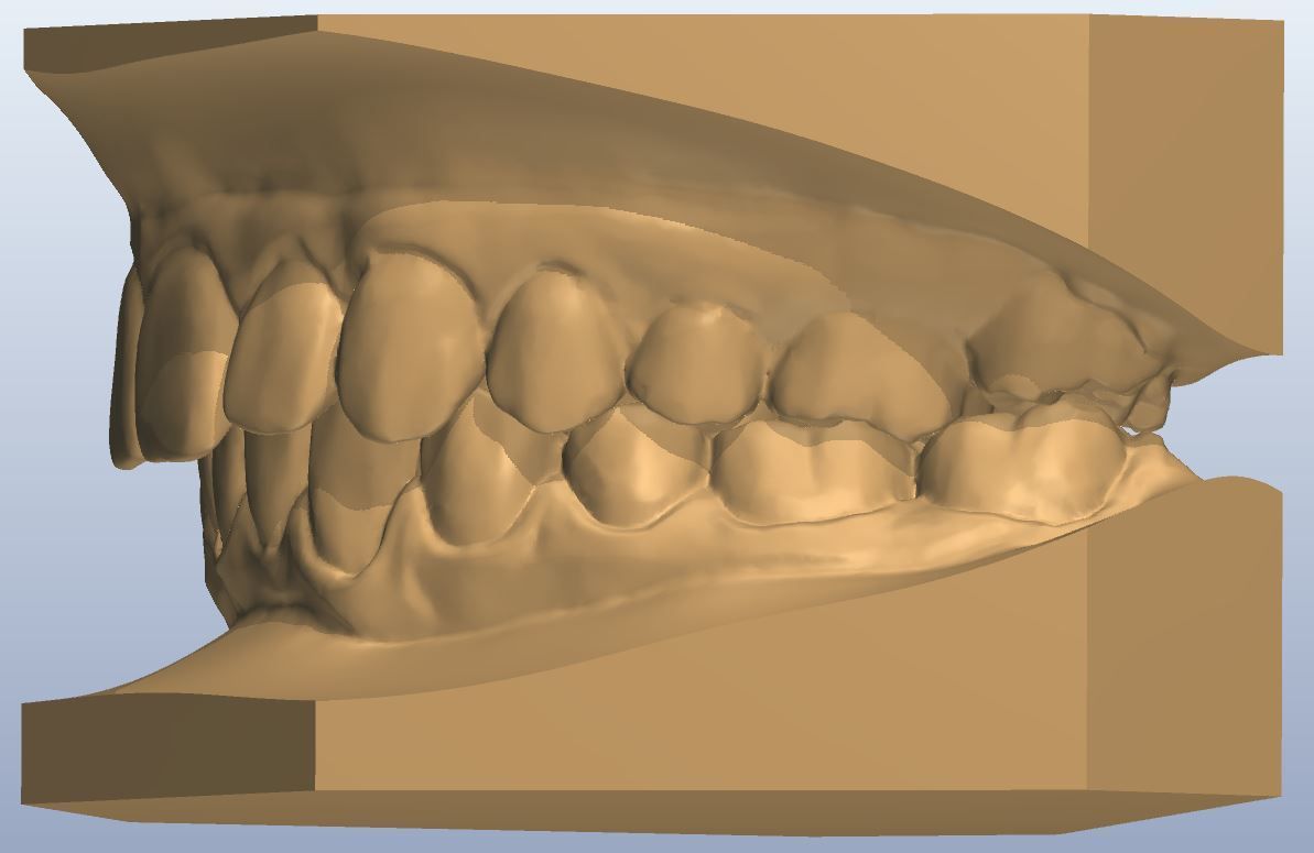 Файл STL dental,teeth,tooth,mouth・Дизайн 3D принтера для загрузки・Cults