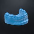 m1.jpg dental model