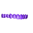 Upper Teeth.stl Digital Full Dentures with Combined Glue-in Teeth Arch
