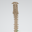 FULL-VERTEBRA-9.png 3D CÁNCER DE CUELLO UTERINO CON ÚTERO, GANGLIOS LINFÁTICOS, SISTEMA URINARIO, VÉRTEBRAS Y PELVIS
