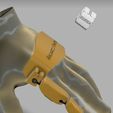 IMG-20230919-WA0065.jpg finger prosthesis with tensor
