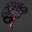 35.png 3D Model of Brain and Aneurysm