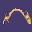 Clipboard-2024-06-11-20-24-34.jpg DIGITAL PARTIAL REMOVABLE DENTURES ( upper + lower + 3D MODELS !) - flexible