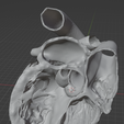19.png 3D Model of Heart (apical 5 chamber plane)