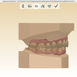 Screenshot_3.png Digital Orthodontic Study Models with Virtual Bases