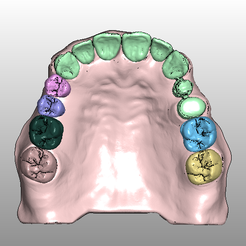 Model_11.png Dental_model_11