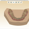 Screenshot_6.png Digital Orthodontic Study Models with Virtual Bases