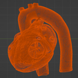 4.png 3D Model of Heart with Tetralogy of Fallot (ToF)