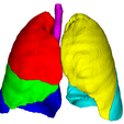 3.png 3D Model of Lungs, Vessels and Airways - generated from real patient