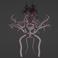 20.png 3D Model of Brain and Blood Supply - Circle of Willis