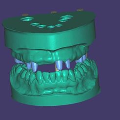 modelli-2.jpg STL file Dental Models with Articulator・3D printable model to download