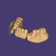 Clipboard-2024-12-21-00-21-16.jpg DIGITAL FLEXIBLE PARTIAL DENTURES upper + lower (3D models !!!) - 11 stl files for download