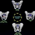 pelvis-types-hip-bone-labelled-detailed-3d-model-d090640efc.jpg Pelvis types hip bone labelled detailed 3D model