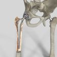 Image2.jpg Hip Replacement model