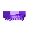 1234567890_Splint_Appliance7_ScannedModel {Maxilla}.stl Digital Anti-Migraine Appliance