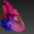 07.png 有心房间隔缺损的心脏 3D 模型