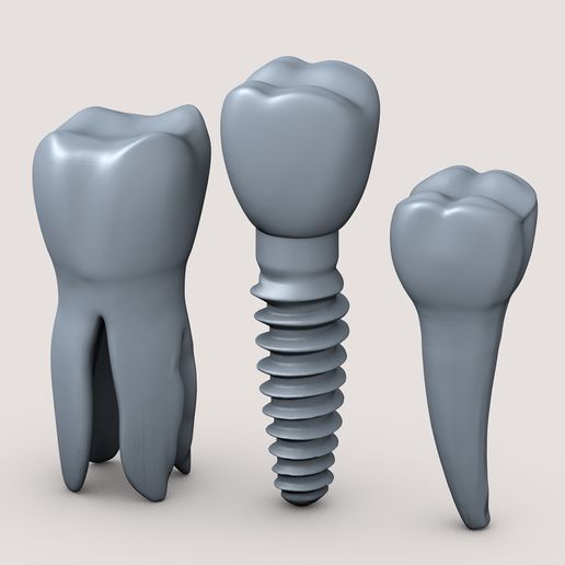 Dental-implant0001.jpg Dental Teeth & Implant Set – Stylized 3D Medical Model