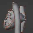 7.png 3D Model of Heart with Tetralogy of Fallot (ToF)