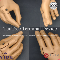 Screenshot_12.png Fichier STL gratuit Terminal TuuTree - Prothétique・Design pour imprimante 3D à télécharger