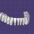 Dentes-Mandibula-Robtoly-Unique-Exocad.jpg Teeth Lower Jaw - Exocad - Robtoly-Unique
