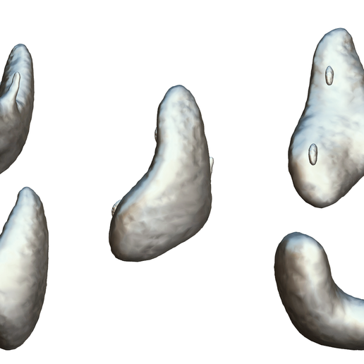 Thyroid_Matcap_1.png Tiroides sana y cáncer de tiroides