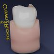 image-0019.jpg Corte esquemático de los dientes etiquetado
