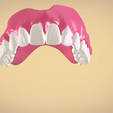 Screenshot_8.png STL file Full Dentures with Many Production Options・3D printable model to download, LabMagic3D