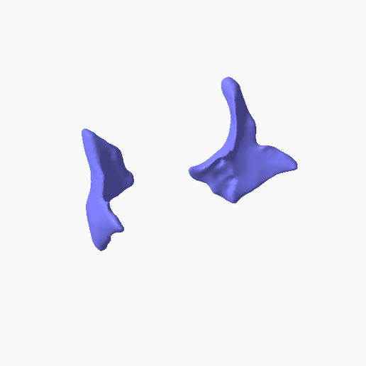 4.png ZYGOMATIC BONE PARTIAL SEGMENTED 3D MODEL
