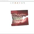 Screenshot_7.png Digital Try-in Full Dentures for Injection Molding