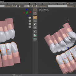imagen_2022-09-18_225006596.png OBJ file 4. 9. Collection of anterior sup and inf zone・Template to download and 3D print