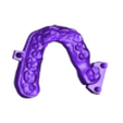 789513050_20240102_0817_Tech_01_BD_H_UnsectionedModel_UpperJaw.stl DIGITAL BLEACHING TRAYS - 4 stl files (upper tray, lower tray, model, antagonist)