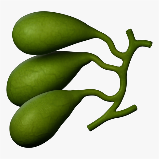 Gallbladder Triple Triplication Type 3 – H+H Shaped Anatomy