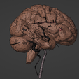 7.png 3D Model of Brain and Blood Supply - Circle of Willis