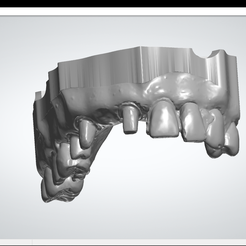 File View Help - 8x Trdotad 2 peaches ‘SF en eG ee 3shape> Free STL file Working models for veneers・3D printing template to download